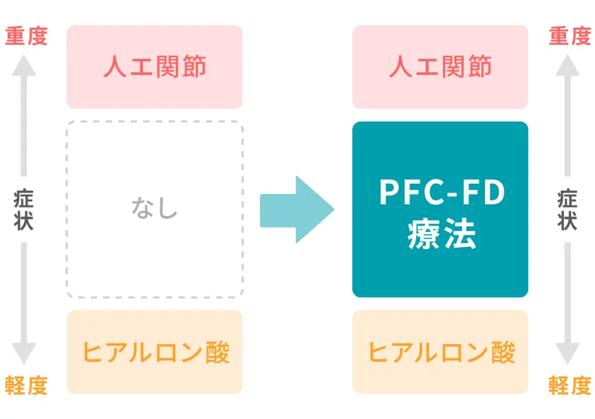PFC-FD療法の立ち位置