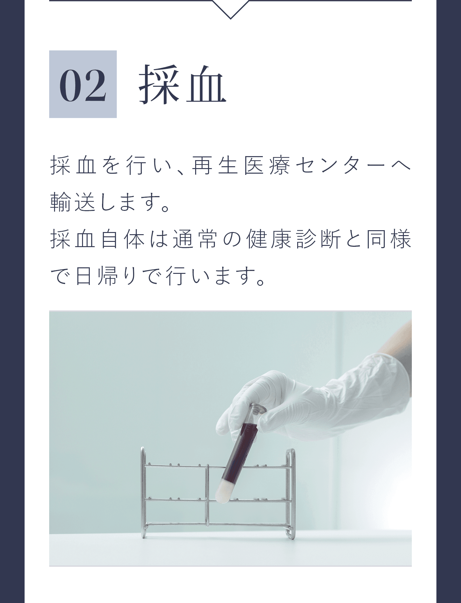 02|採血 採血を行い、再生医療センターへ輸送します。採血自体は通常の健康診断と同様で日帰りで行います。