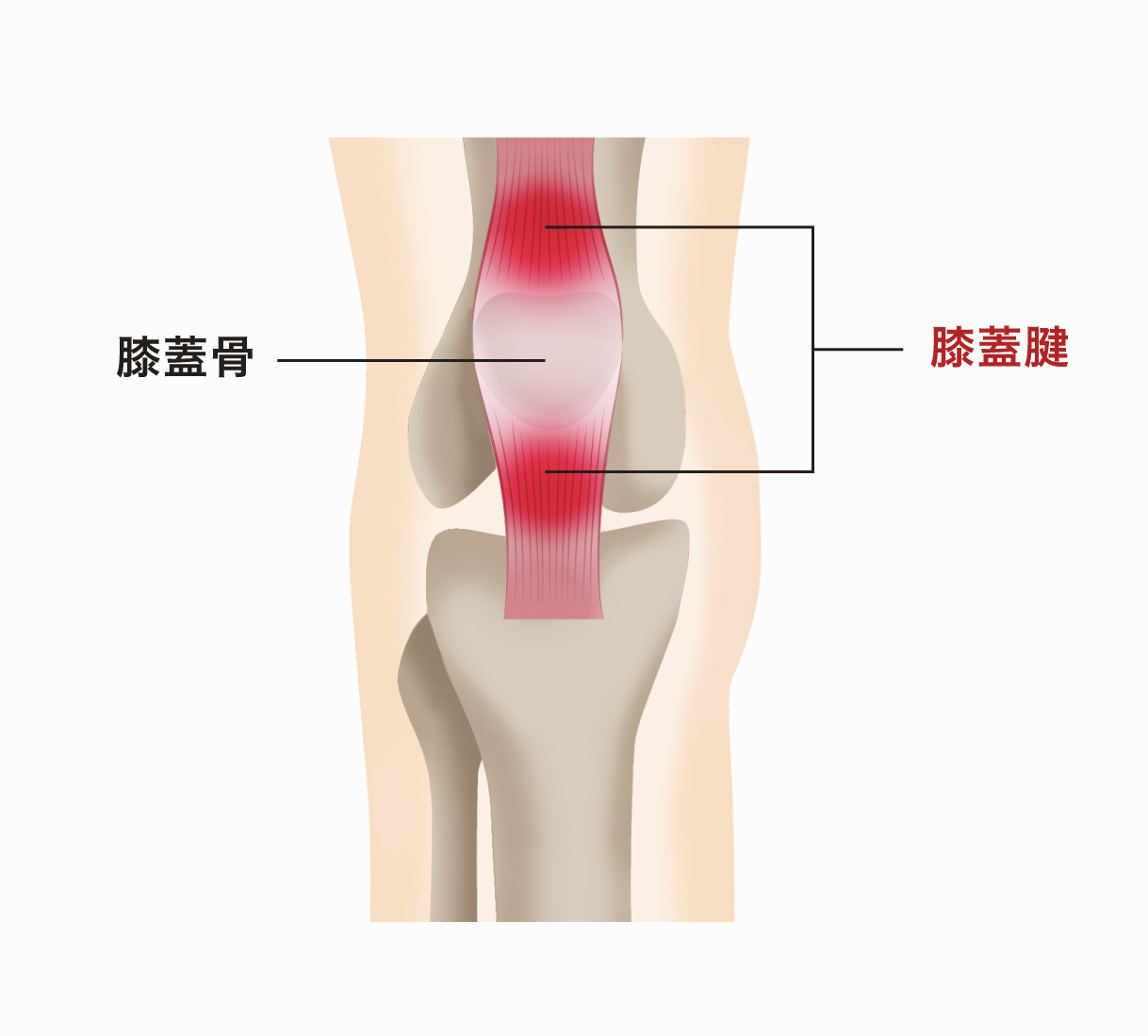 膝 を つく と 激痛