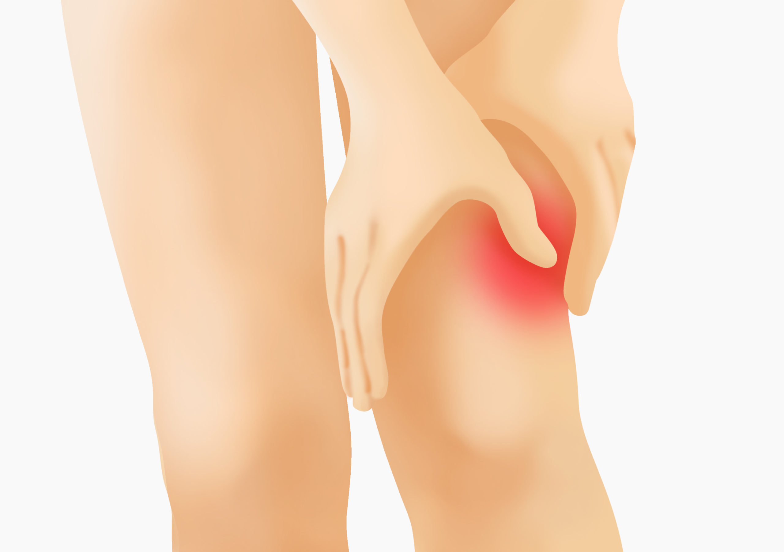 腸脛靭帯炎 ランナー膝 とは 膝の外側が痛くなる疾患を医師が解説 関節治療オンライン