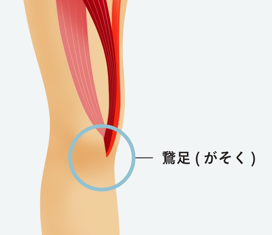 鵞足炎 がそくえん とは 膝の内側が痛む鵞足炎を医師が解説 筋腱 関節治療オンライン