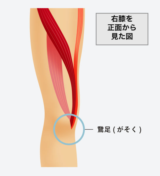 がそくえん とは 膝の内側が痛む鵞足炎を医師が解説 ひざ 関節治療オンライン