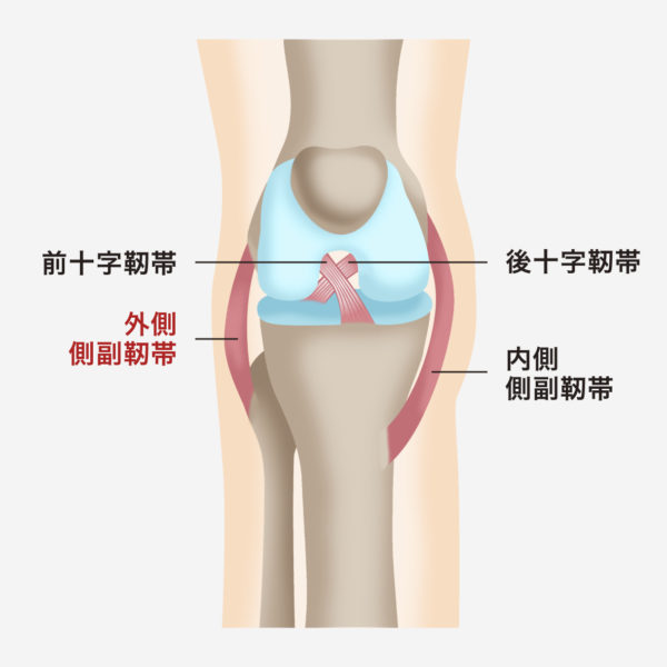 膝外側側副靭帯損傷の原因や症状 治療方法について医師が解説 関節治療オンライン