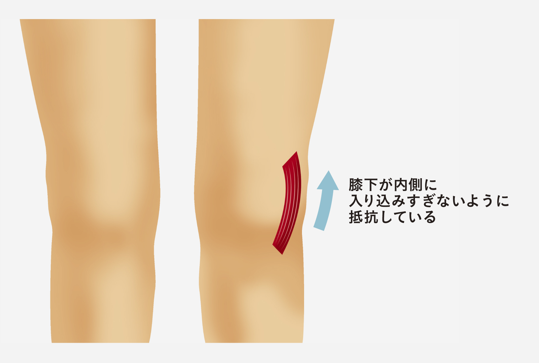 膝下 外側 の 痛み