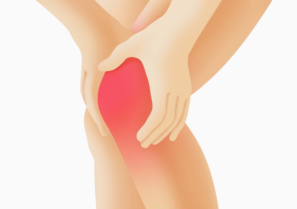 膝を曲げると痛い場合に考えられる4つの疾患 変形性膝関節症 関節治療オンライン