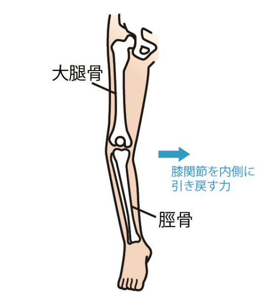 O脚の進行を防ぐ、膝関節を内側に引き戻す力