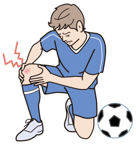 スポーツの際に膝痛が生じている男性