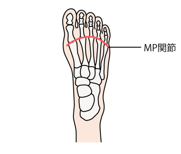 足のMP関節