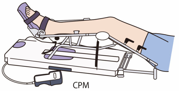 膝関節のリハビリ CPM（continuous passive movement）